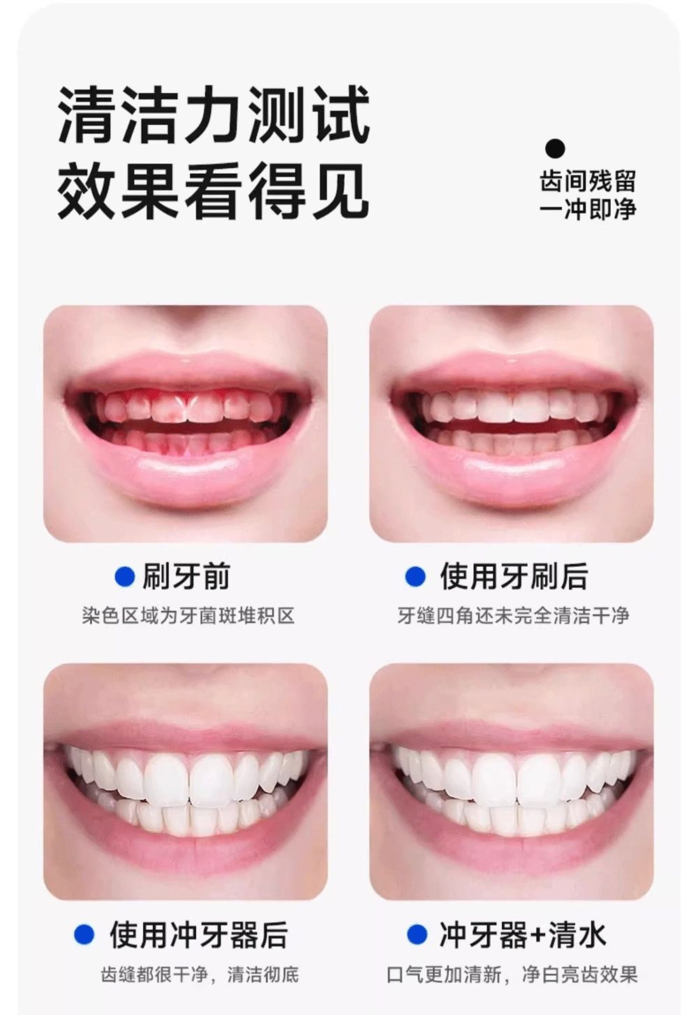 电动冲牙器家用清洁口腔便携式洗牙器正畸专用牙结石洁牙款水牙线