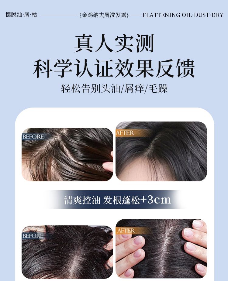 金鸡纳去屑洗发水滋润清爽焗油顺滑洗发水洗头膏去屑止痒洗发露