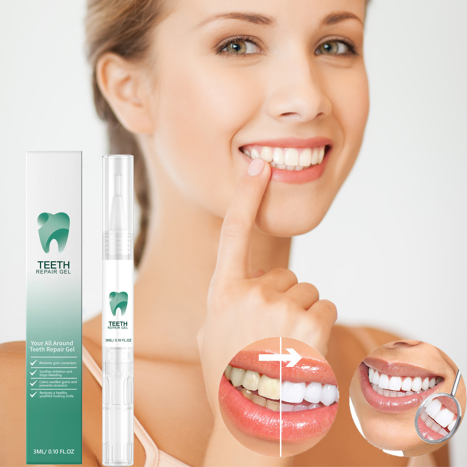 Teeth care gel pen for tartar and stain removal