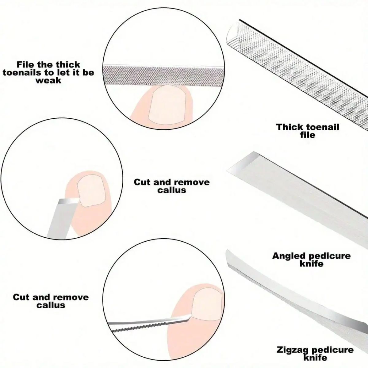 Nagelpflege-Set 5-teilig mit Werkzeugen für eingewachsene Nägel