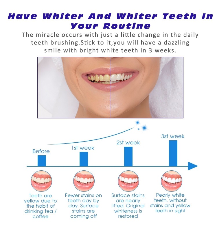 V34 purple teeth whitening strips, large box