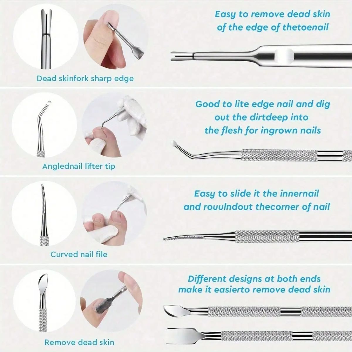 Nagelpflege-Set 5-teilig mit Werkzeugen für eingewachsene Nägel