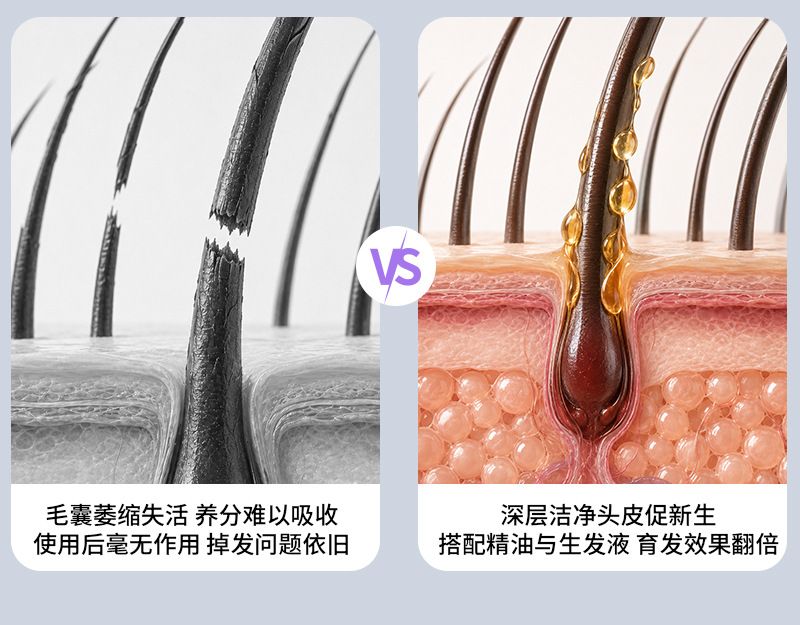 抓揉生发梳头皮电动按摩梳红光防密脱生发仪精油导液梳头部上药器