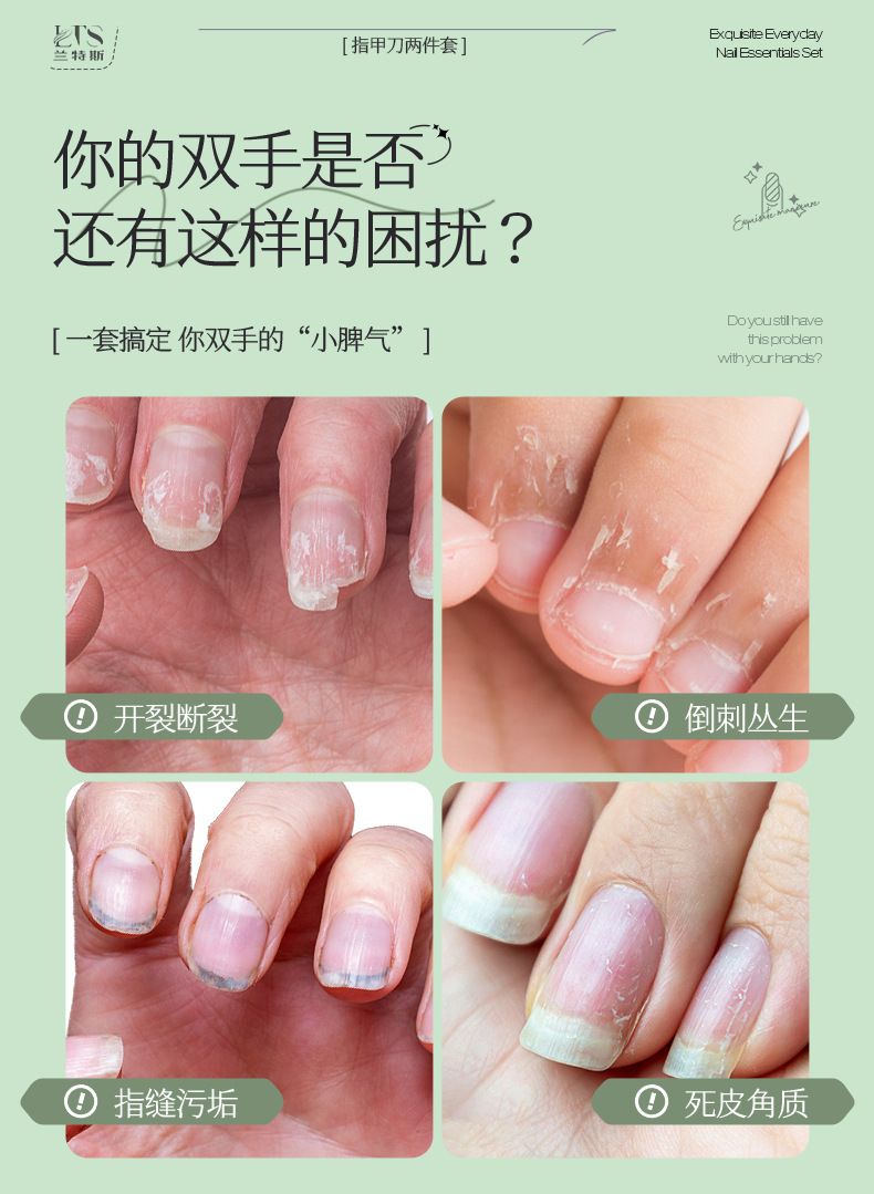 Nagelschere Set für Heim-Pediküre und Maniküre