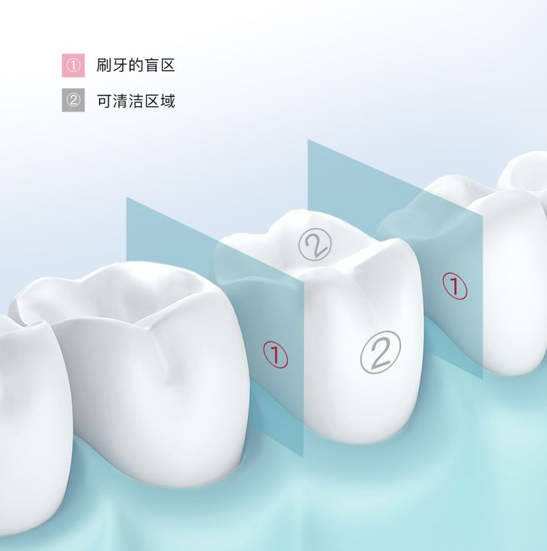 拜尔M401冲牙器家用电动便携式水牙线正畸专用清洁牙齿缝洗牙声波