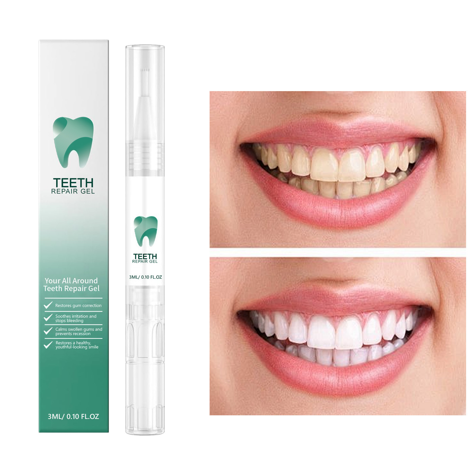 Teeth care gel pen for tartar and stain removal