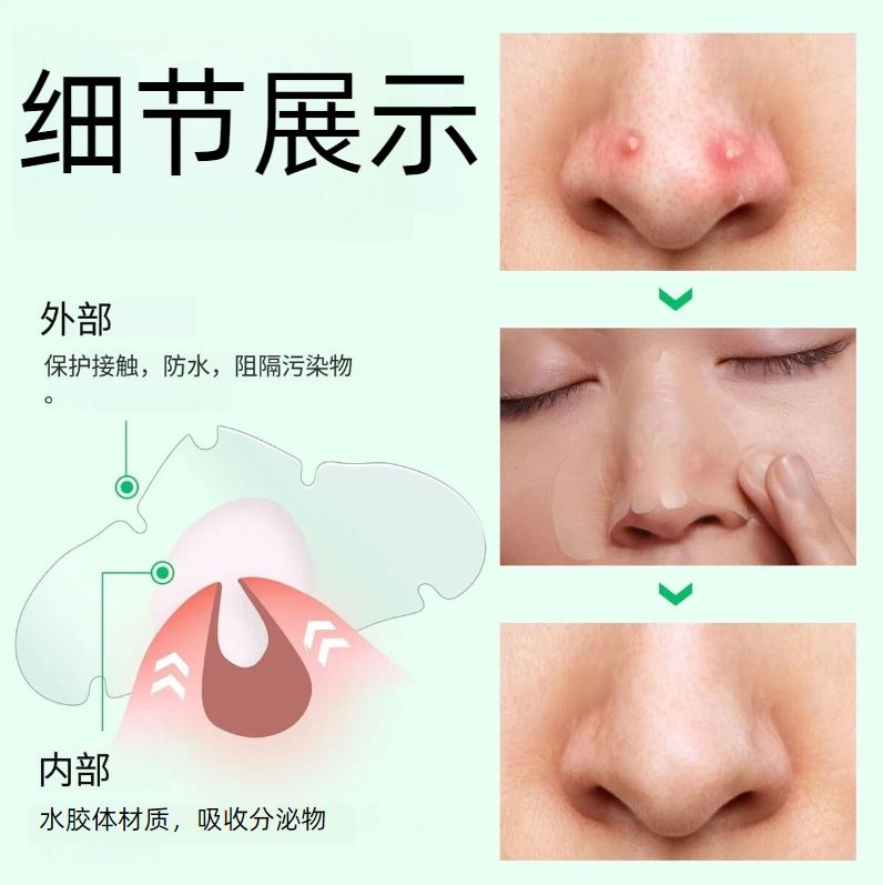 跨境水胶体鼻贴大面积痘痘贴长方形痘痘贴一次性用品水胶体鼻贴