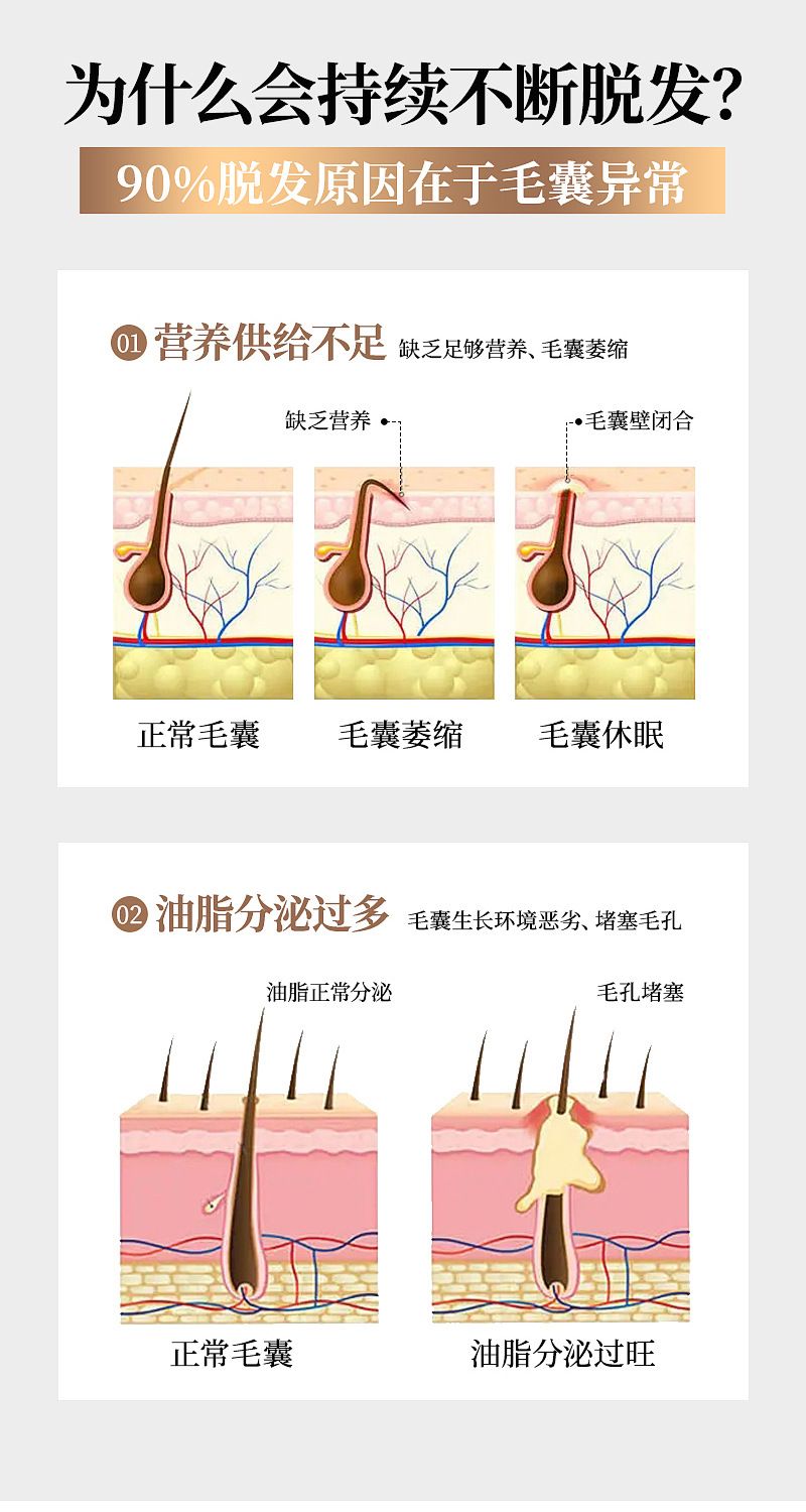 腺苷生发液激活毛囊防脱育发液头皮精华液当归生发液猛长头跨境