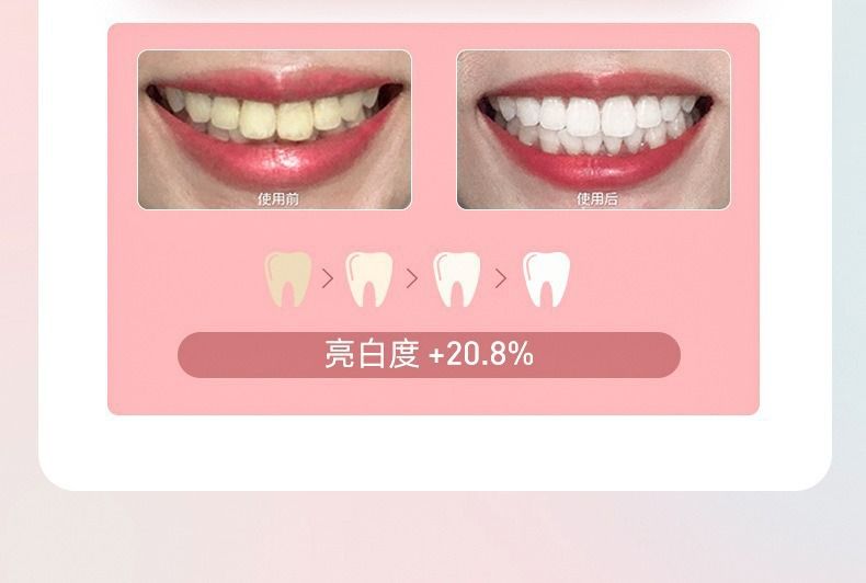 厂家批发软毛牙刷冲牙器便携式成人儿童通用超声波电动牙刷充电款