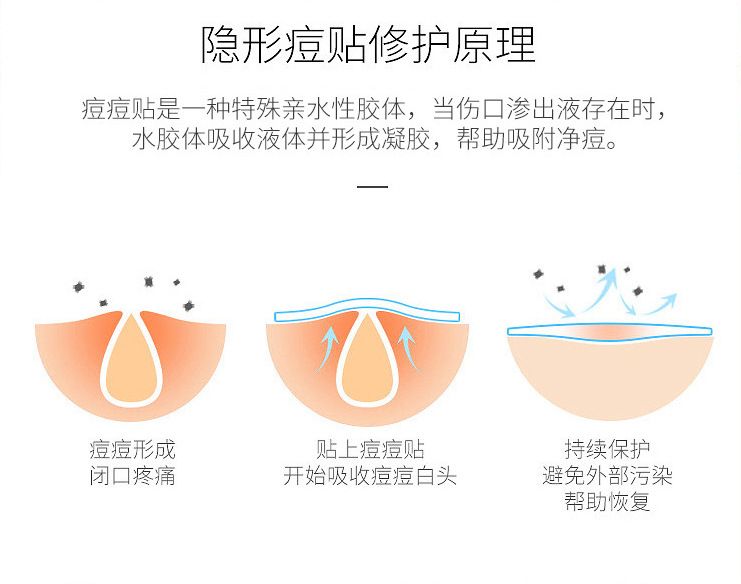 厂家跨境痘痘贴批发彩色卡通蝴蝶防水PE24粒20粒蝴蝶卡通痘痘贴