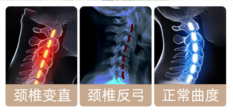 荞麦凉席颈椎枕夏季藤席凉感护颈枕家用可拆洗透气加热花草枕头