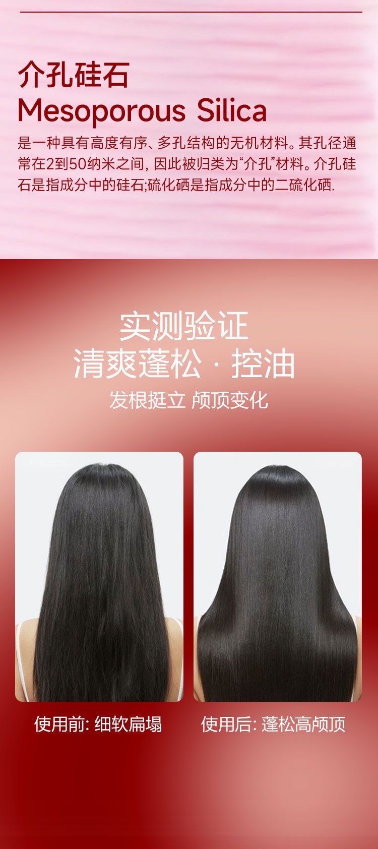 控油清洁头皮持久去屑止痒温和养护发丝柔顺蓬松去屑洗发水300ml