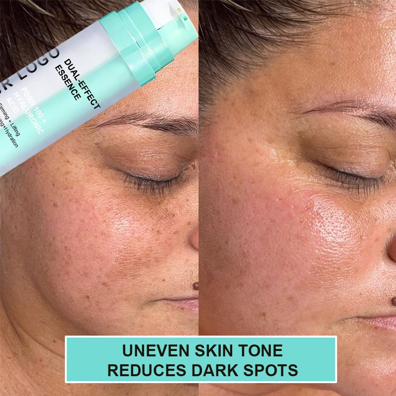 Hyalüronik asit serum, gündüz gece bakım, nemlendir antioksidan