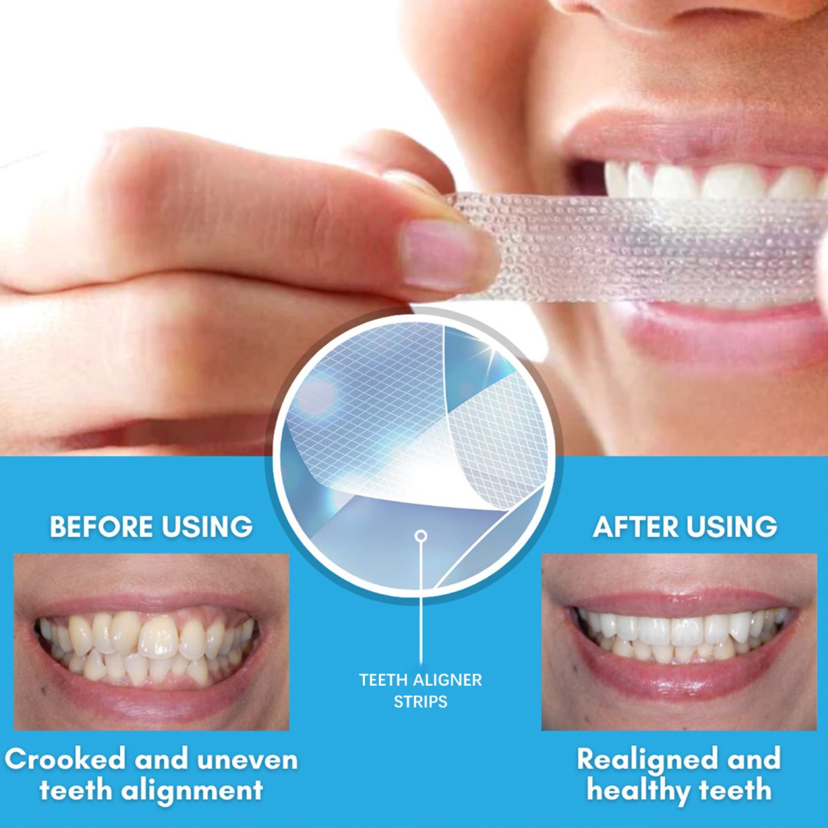 ORALHOE teeth whitening strips with plaque removal