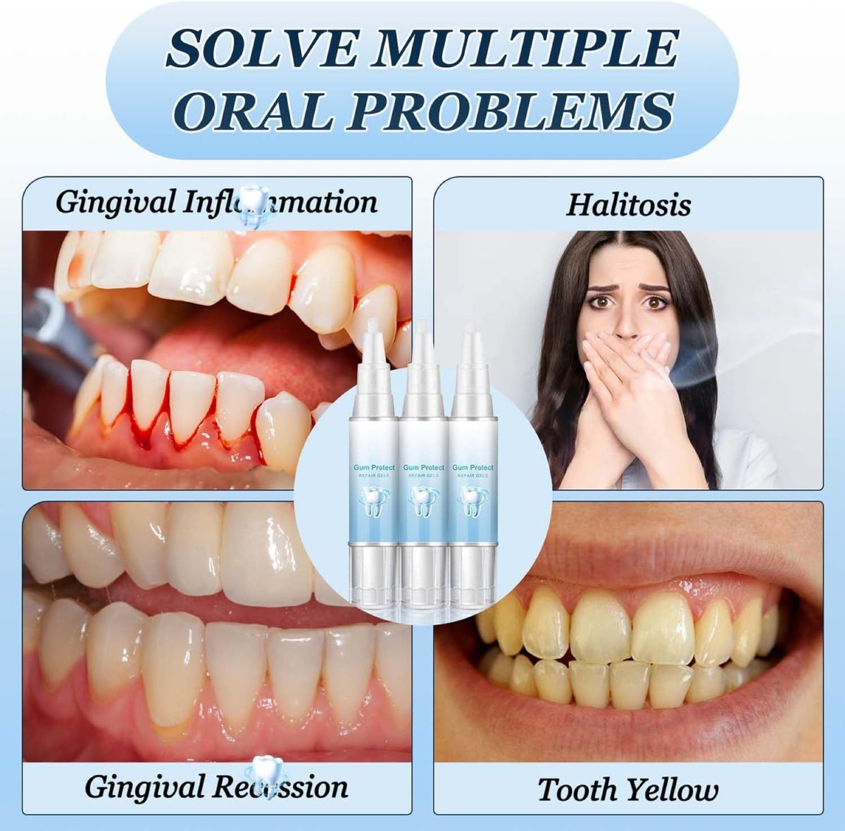 Gum Protect diş temizleme kalemi, leke çıkarıcı, ağız jeli
