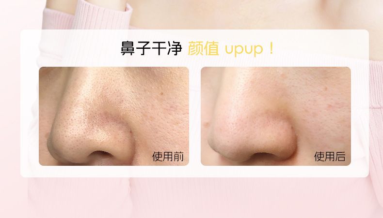 韩姬莲黑头净透鼻贴小猪鼻贴净颜去黑头鼻贴双重净润祛黑头温和