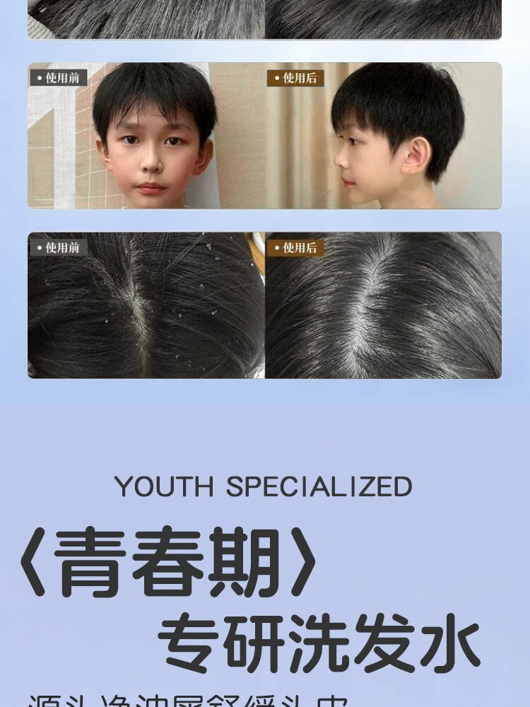 Shampoo büyük boy, yağ kontrolü, kepek giderici, amino asit formülü