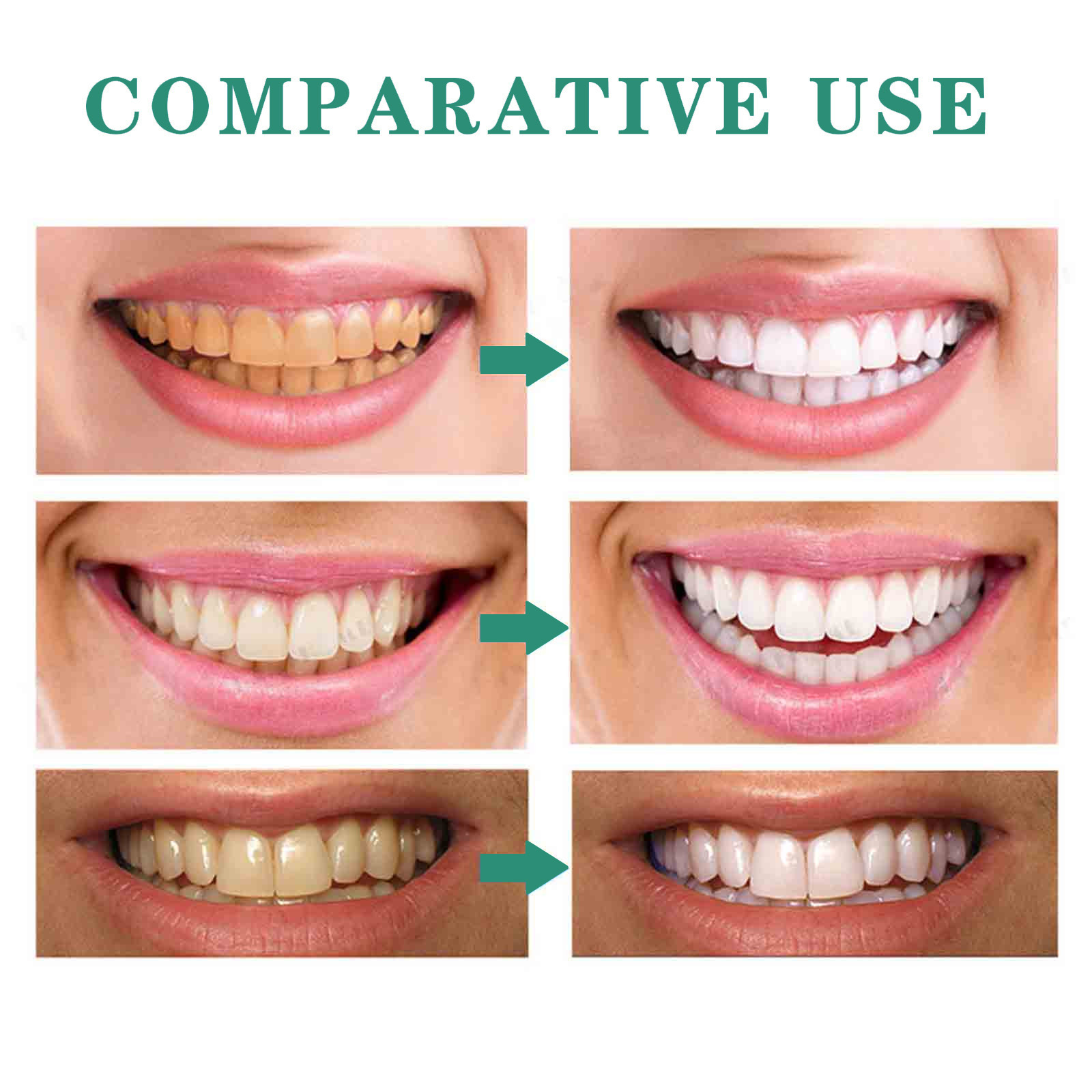 Teeth care gel pen for tartar and stain removal
