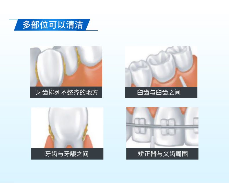 家用冲牙器水压驱动无损安装洁牙器非电池电压驱动环保便携正品