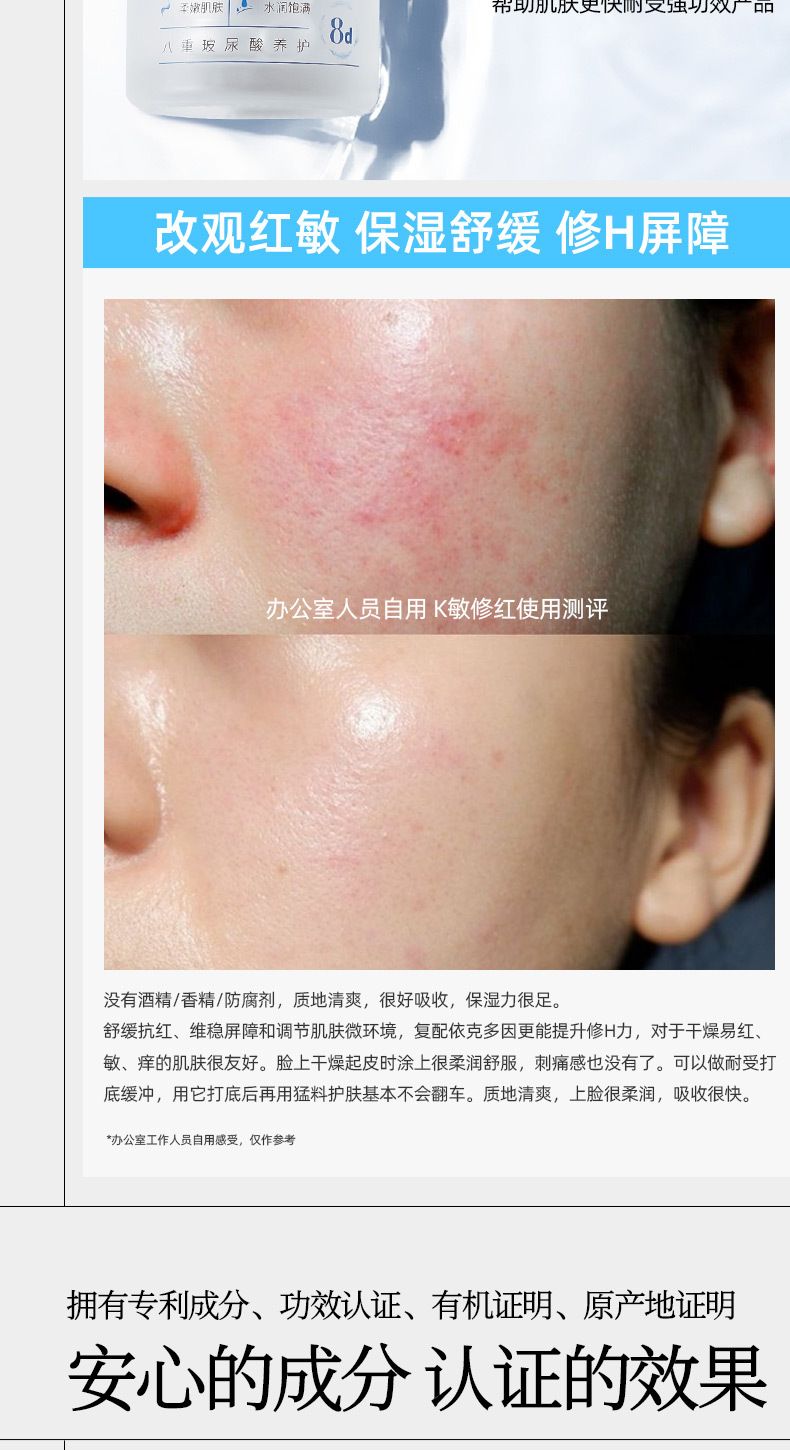 瑶瑾芳依克多因泛醇B5精华液玻尿酸保湿舒缓修H面部男女现货批发