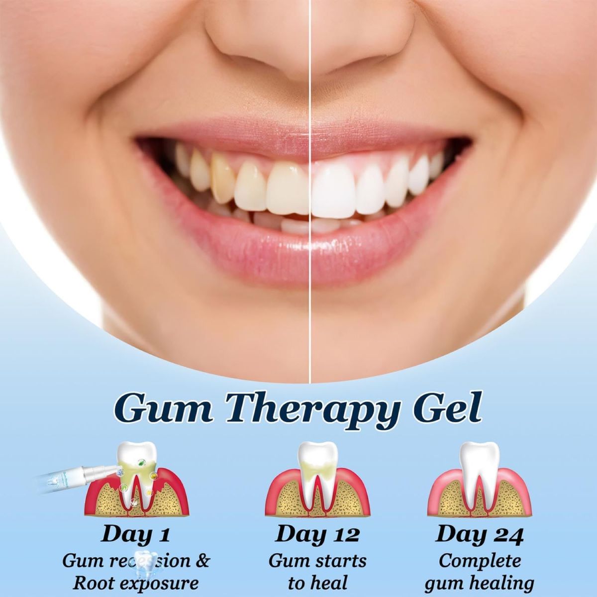 Gum Protect diş temizleme kalemi, leke çıkarıcı, ağız jeli