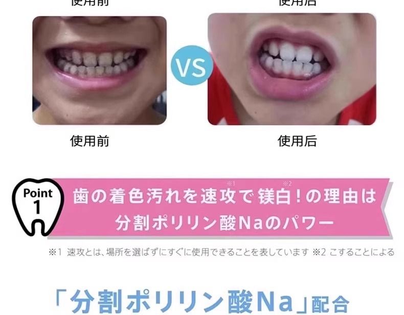 Nano teeth cleaning wipes for adults and children