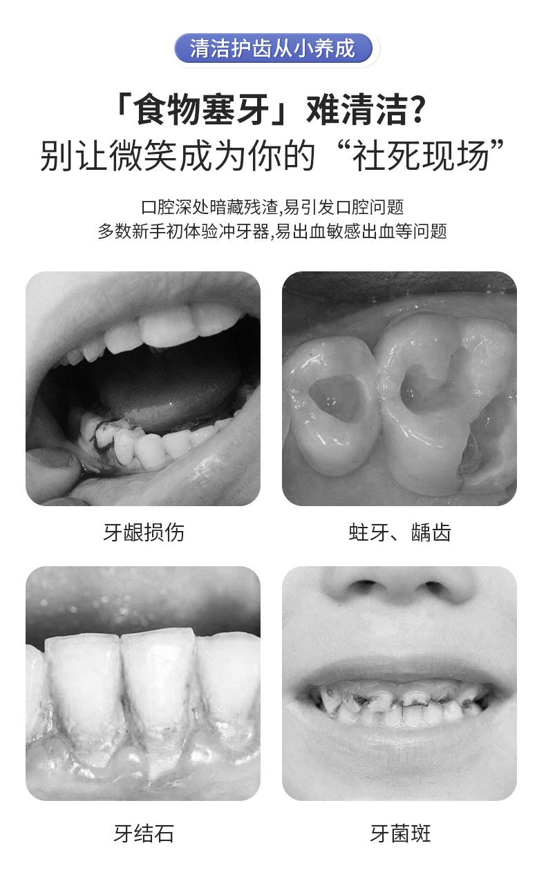 电动冲牙器家用便携伸缩水箱超声波除牙石防水水牙线口腔洁洗牙器