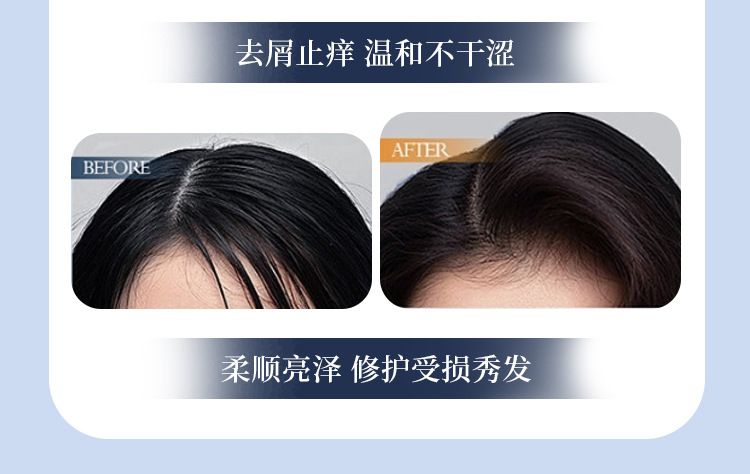 金鸡纳去屑洗发水滋润清爽焗油顺滑洗发水洗头膏去屑止痒洗发露