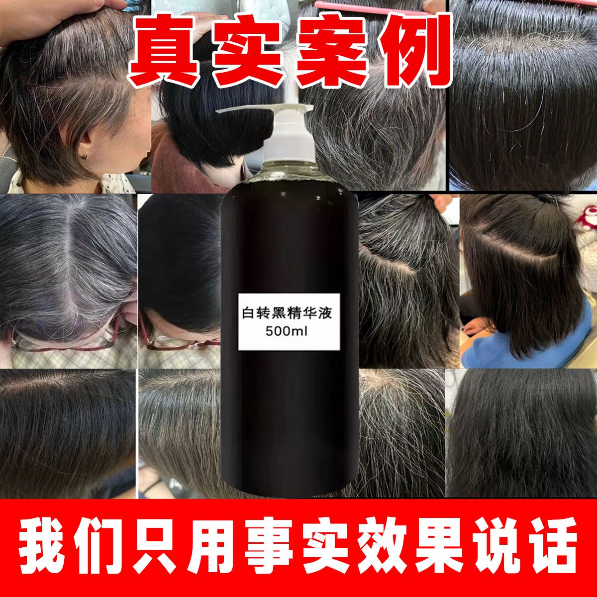 白发转黑发精华液何首乌原液发根养黑滋养毛囊养发护发防脱育发液