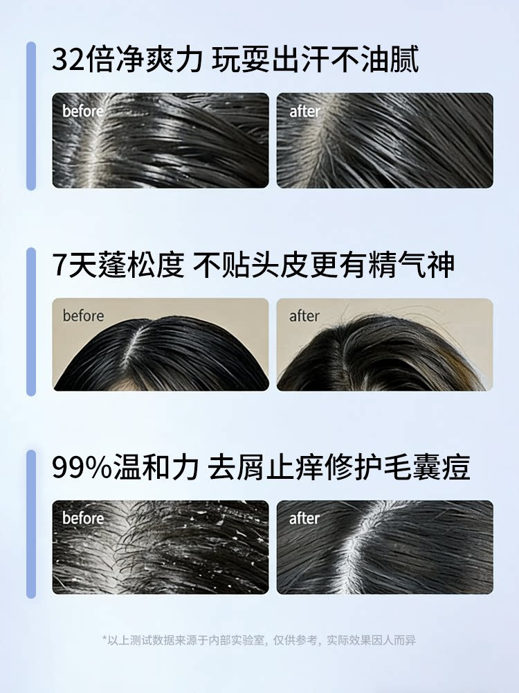 Shampoo büyük boy, yağ kontrolü, kepek giderici, amino asit formülü