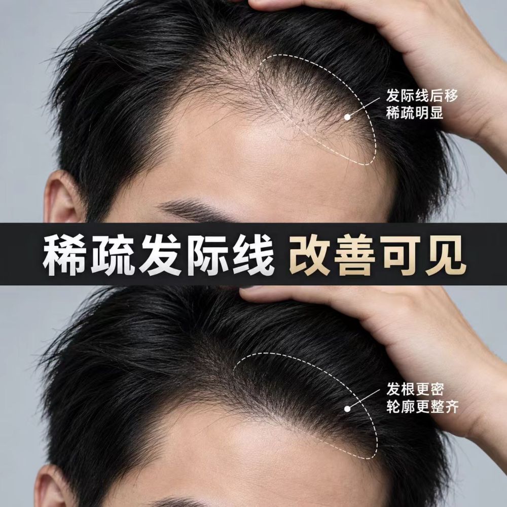 Polygonum Multiflorum Ginseng Anti-Hair Loss Serum, Scalp Care Essence