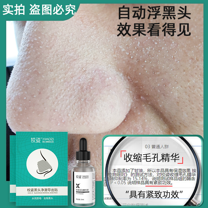Nose Strips Set, Blackhead Removal, T-Zone, Pore Tightening