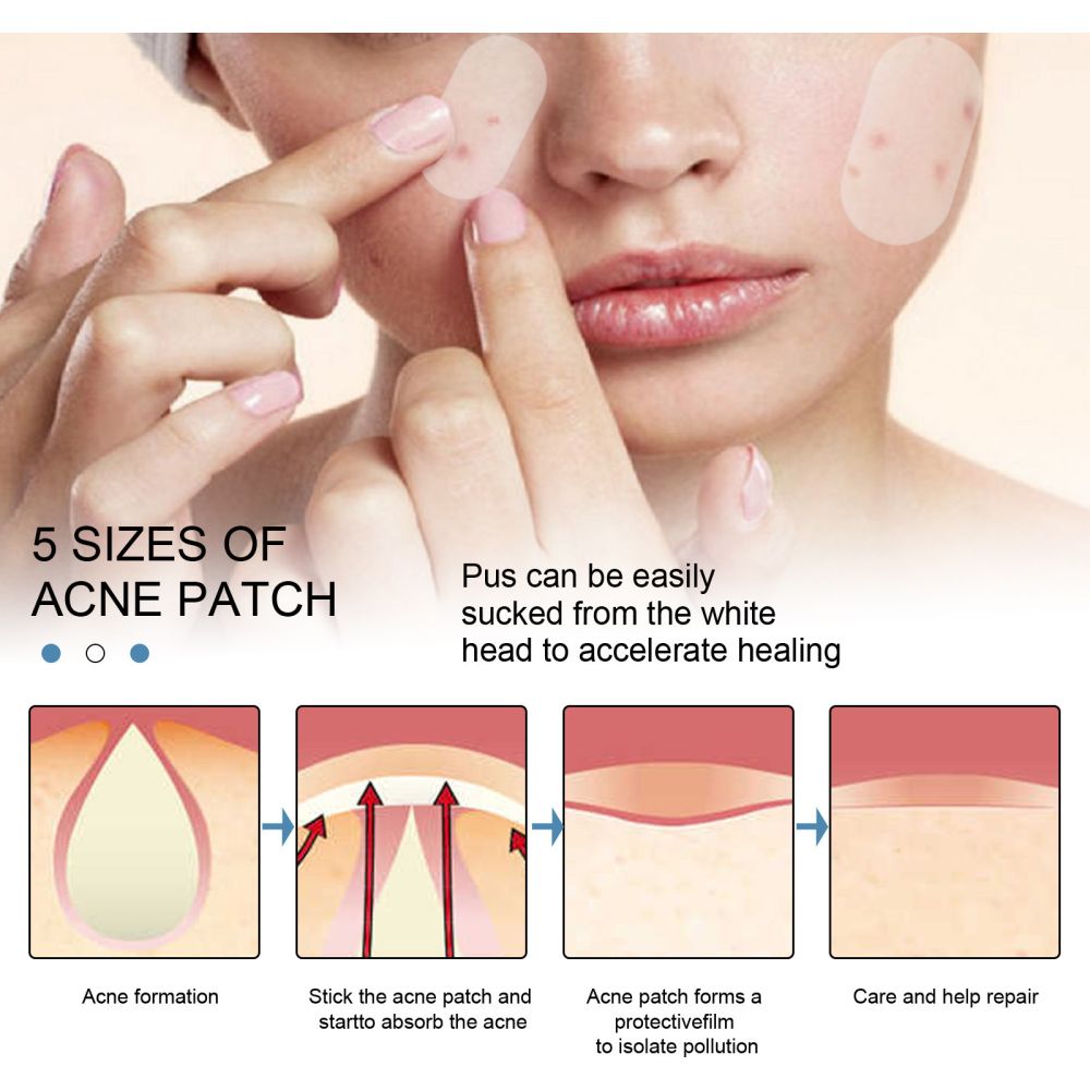 EELHOE acne patch, invisible, makeup-compatible, waterproof