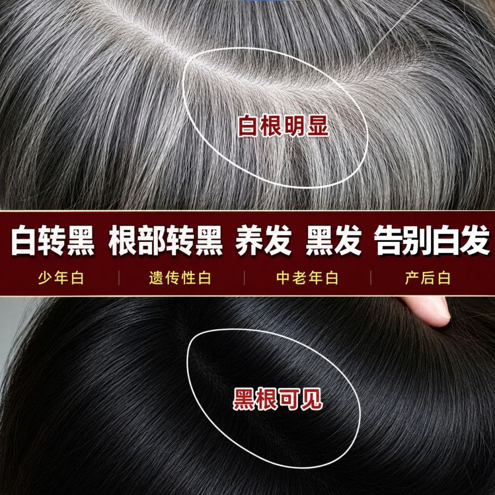 白转黑精华液乌黑滋养液滋养毛囊坚韧发根育发液防脱膏何首乌草本