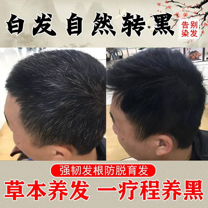 白转黑乌黑滋养液精华液滋养毛囊坚韧发根育发防脱发何首乌育发液 - 1