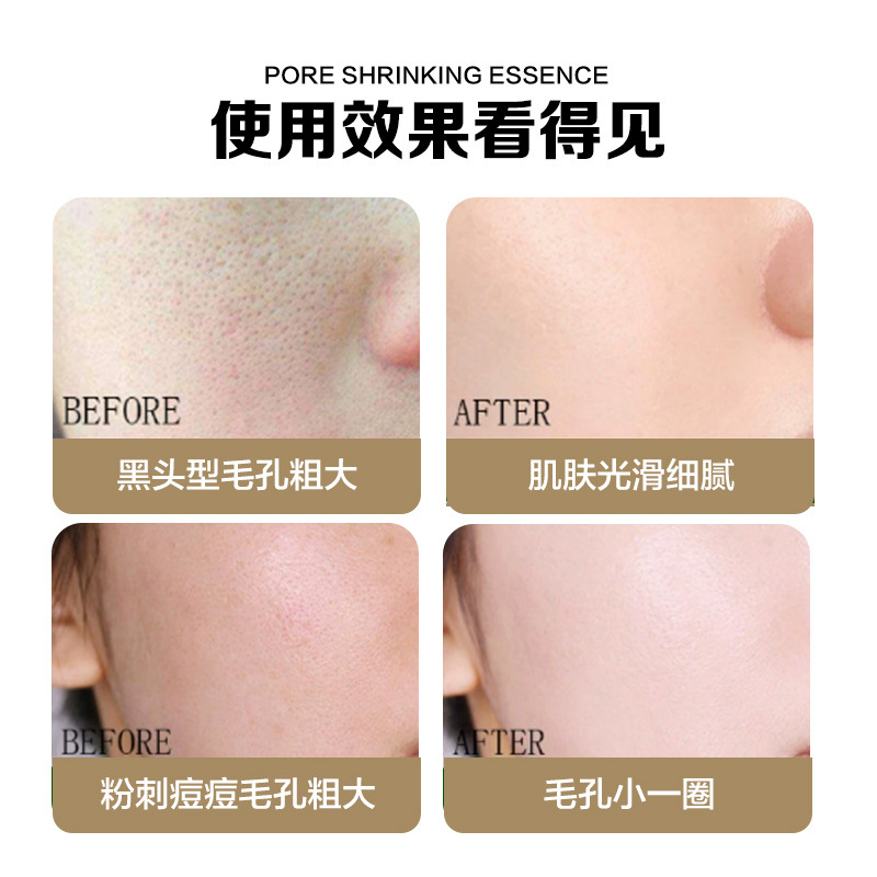 Hyalüronik asit özü serum, ince çizgiler ve nemlendirme için