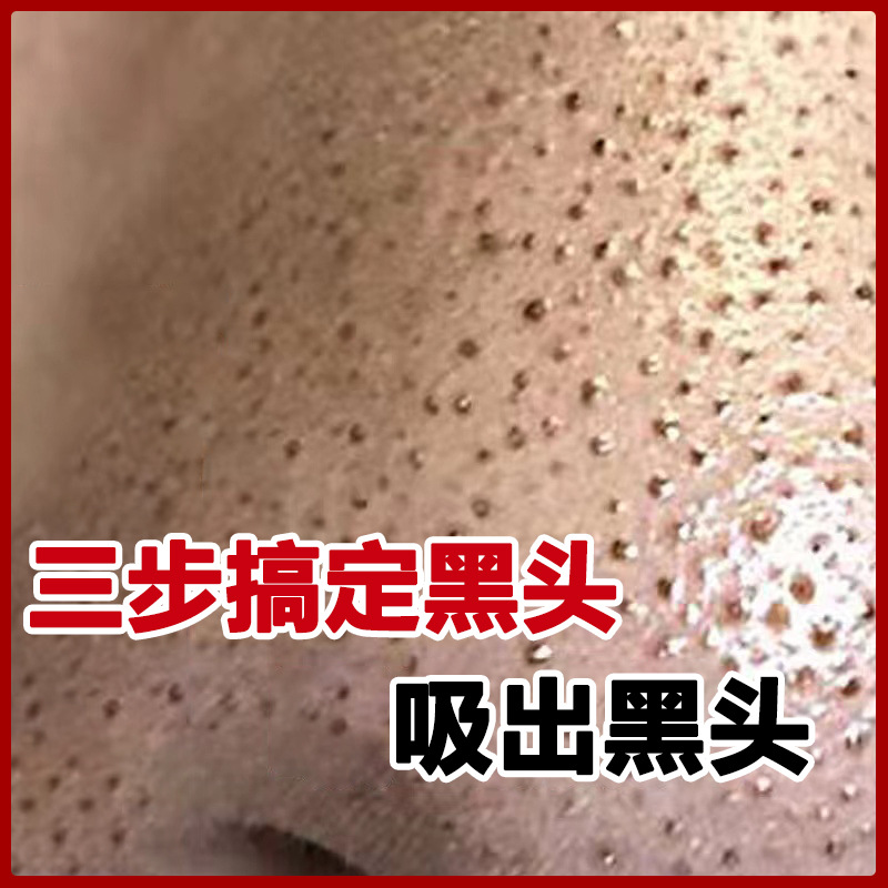 去黑头鼻贴套盒T区祛粉刺收缩毛孔黑头导出液去黑头的鼻贴鼻头贴