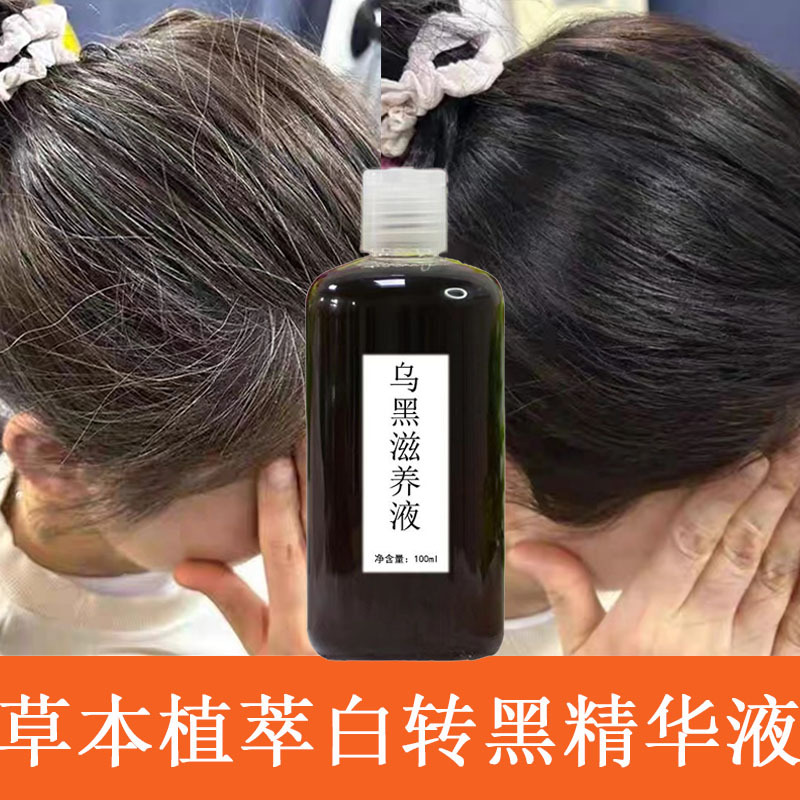 何首乌白转黑精华液白发养黑发原液黑灵芝养发乌发生发滋养育发液 - 1