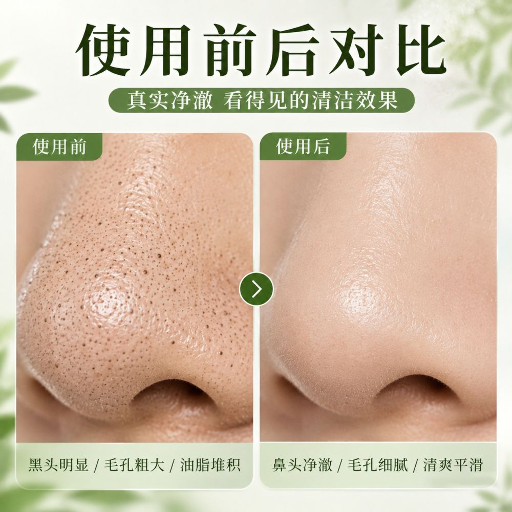 水杨酸清洁泥膜去黑头泥膜去粉刺面膜深层清洁肌肤果酸收缩毛孔霜