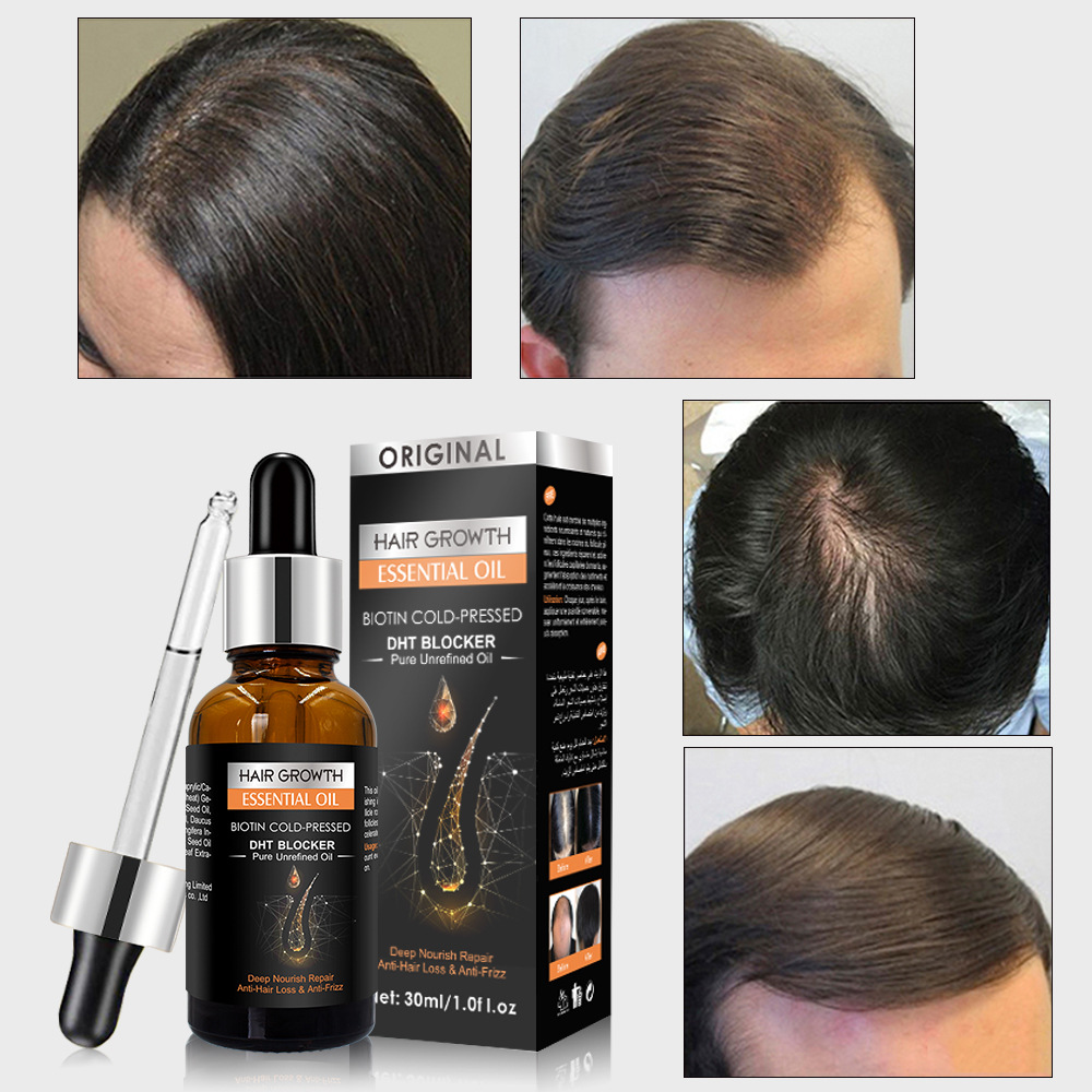 Ginger Hair Oil, Scalp Care, No-Rinse Massage Oil