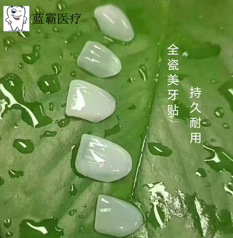 全瓷美牙贴面 牙齿贴片全瓷贴片私人美牙贴冰瓷蓝瓷琥珀瓷贴片