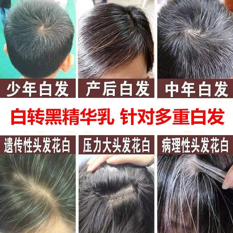 何首乌白转黑精华液白发转黑发营养液滋养毛囊养发护发防脱育发液