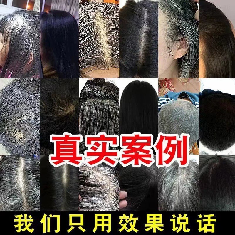 何首乌白转黑精华液白发转黑发营养液滋养毛囊养发护发防脱育发液