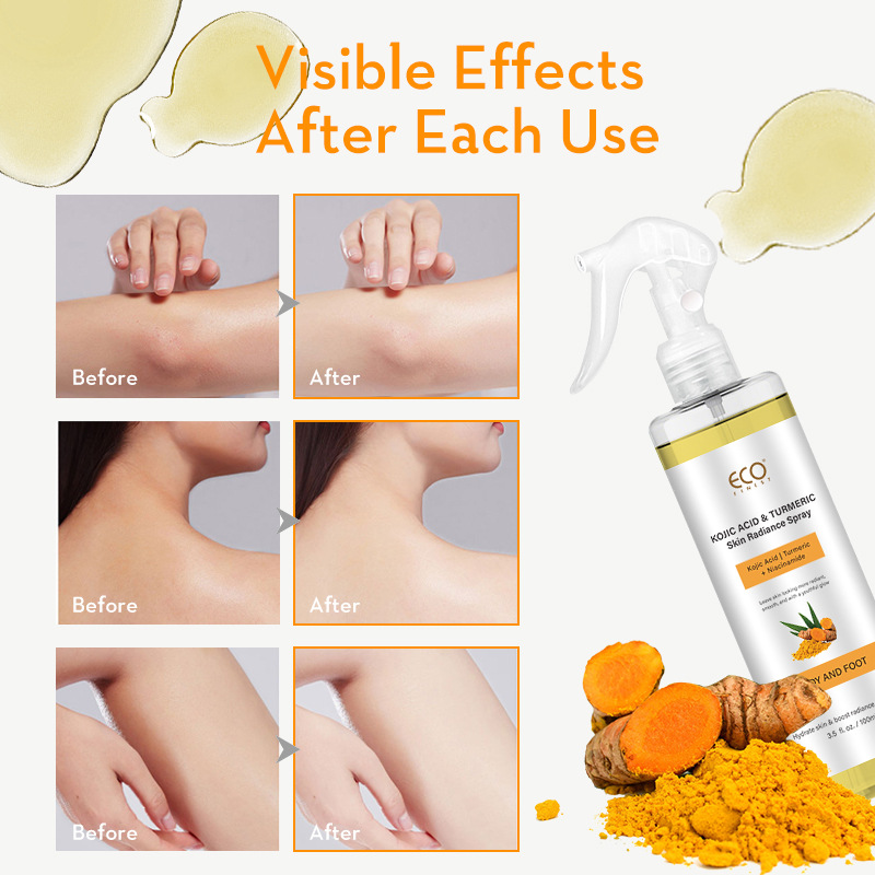 Kojik Asit Zerdeçal Vücut Spreyi, Peeling ve Cilt Tonu Aydınlatıcı - 1