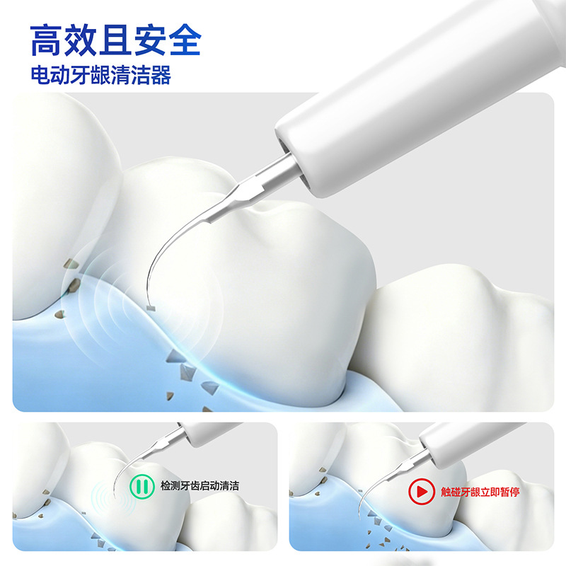 超声波洁牙器去除牙结石口腔清洁牙齿污垢电动洗牙器便携家用跨境