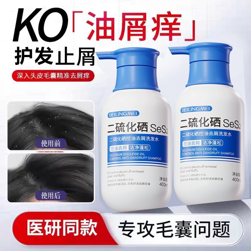 贝玲美二硫化硒控油去屑洗发水毛囊清洁控油蓬松止痒洗头膏正品