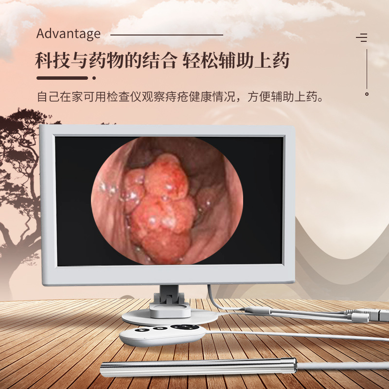 Rectal Endoscope Ultra HD 10 Inch Portable Inspection Camera - 1