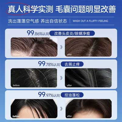 Selenium Disulfide Shampoo Anti-Dandruff and Oil Control - 3