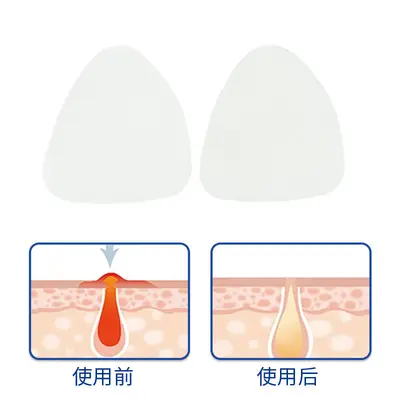 Invisible Forehead and Nose Strips, Peel-Off T-Zone Pore Care - 8
