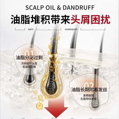 Selenium Disulfide Shampoo, Anti-Dandruff, Oil Control, 3-in-1 - 4
